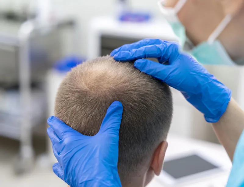 ماذا تتوقع بعد تجميل الأنف